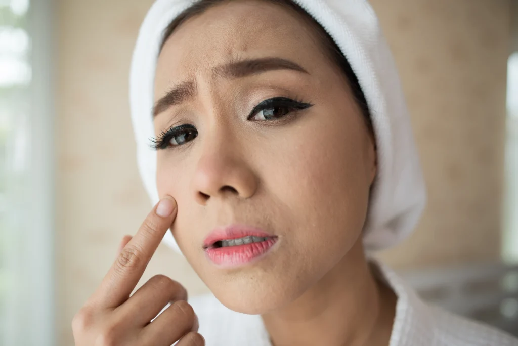 Cara Mengatasi Kulit Kering Dan Mengelupas Secara Natural Untuk Kesehatan Kulit Optimal